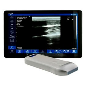 hand-held ultrasound systemWU9 series