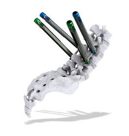 minimally invasive pedicle screw positioning systemThunderbolt™
