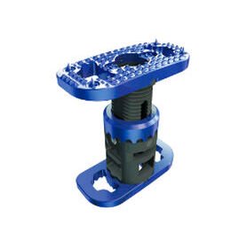 lumbar vertebral corpectomy prosthesisXLIF® Corpectomy