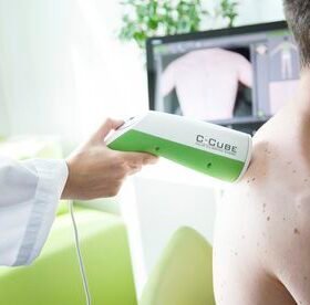 video dermatoscopeC-Cube 3
