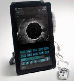 portable ultrasound systemALBIT