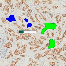 oncology software moduleONCOTOPIX®