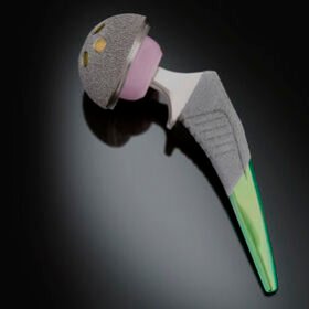 minimally invasive hip prosthesisSpartan