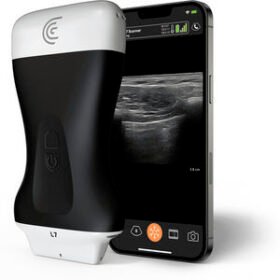 hand-held ultrasound systemL7 HD3