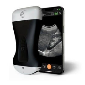 hand-held ultrasound systemC3 HD3