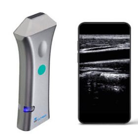 hand-held ultrasound systemSIFULTRAS-3.54
