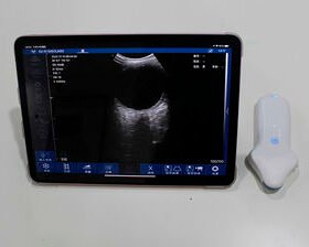 portable ultrasound systemSIFULTRAS-5.04