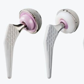 primary hip prosthesis