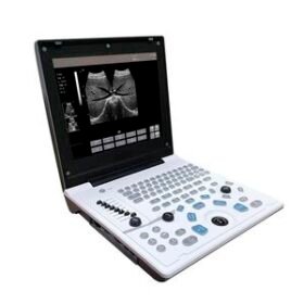 portable ultrasound system5520