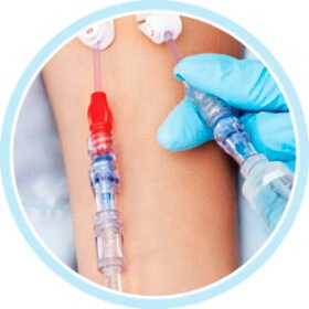 infusion connector with hemostasis valveNeutron®