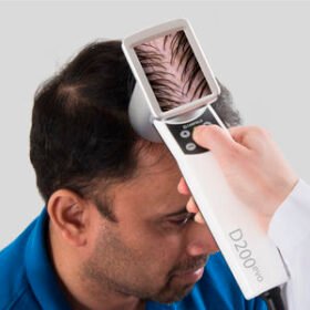 video trichoscopeHairMetrix®