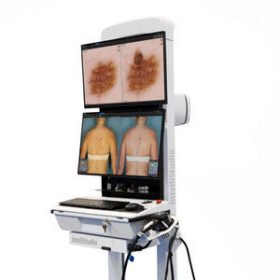 video dermatoscopeIntelliStudio3