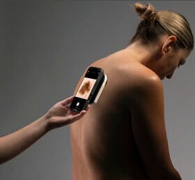 white LED dermatoscopeVEOS®