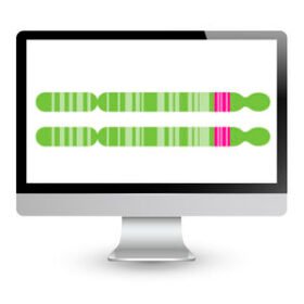 FHSD diagnostic molecular biology analyzerEnFocus™