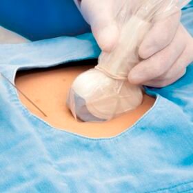 ultrasound probe protective coverDUC8 series