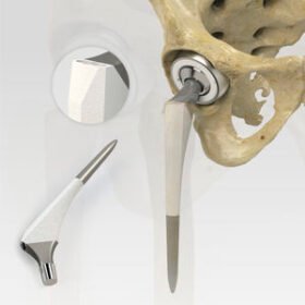 primary hip prosthesis7022-4 series