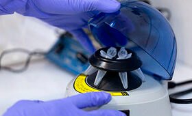 COVID-19 test kit