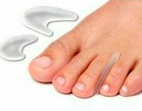 toe separatorMB.FC.108