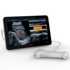 hand-held ultrasound systemUCL