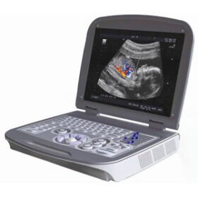 portable ultrasound system6600PLUS