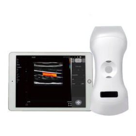 hand-held ultrasound system