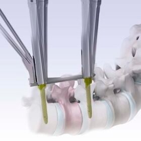 minimally invasive pedicle screw positioning systemVENUS®mini 2.0
