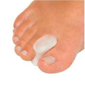 toe separatorAlgeos