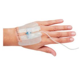 IV catheter band149956