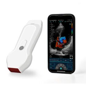 hand-held ultrasound systemYSB-C10XL