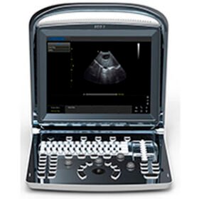 portable ultrasound systemEco 3