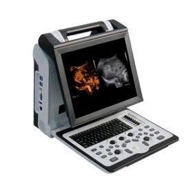 portable ultrasound systemApogee 2300 Pro