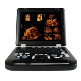 portable ultrasound systemCMS1700A