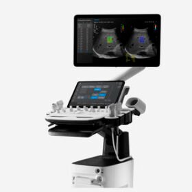 on-platform ultrasound systemV5