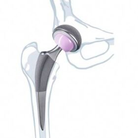 primary hip prosthesisExcia® T