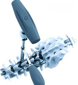 minimally invasive pedicle screw positioning systemHARMONY