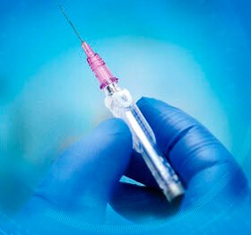 IV infusion needle catheterSuperCath® 5