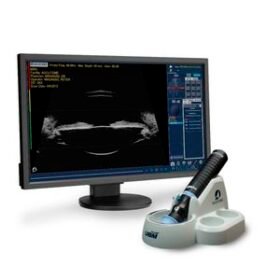 on-platform, tabletop ultrasound systemUBM
