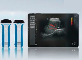 hand-held ultrasound systemuREzpocus