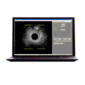 portable ultrasound system(RTCU-S-N) Morpheus® 360° Endocavity US