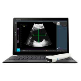 hand-held ultrasound systemRTBU-S-T