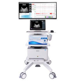 on-platform ultrasound systemRTBU-S-T-VID