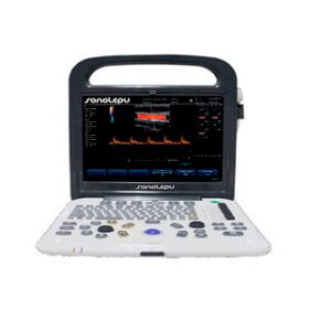 portable ultrasound systemC3