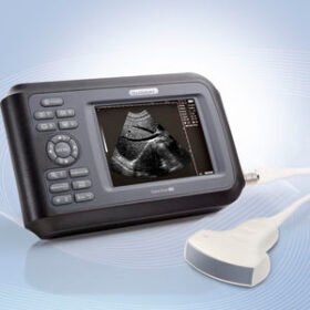 hand-held ultrasound systemHandscan H8