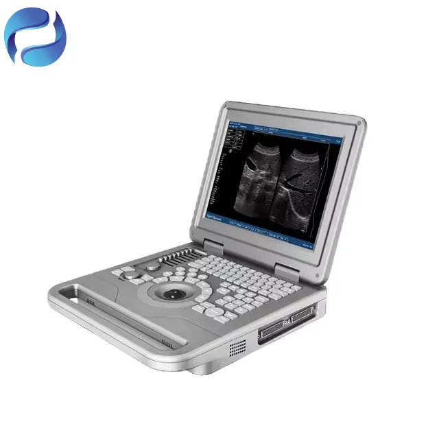 Factory Direct Sales Medical Full Digital Ultrasound System for Veterinary Diagnostic Imaging - Image 3