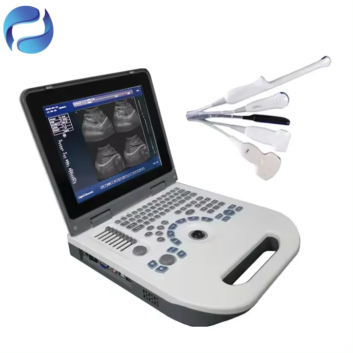 Factory Direct Sales Medical Full Digital Ultrasound System for Veterinary Diagnostic Imaging - Image 6