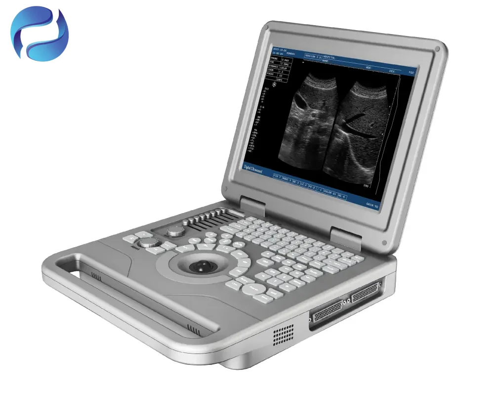 Factory Direct Sales Medical Full Digital Ultrasound System for Veterinary Diagnostic Imaging - Image 4
